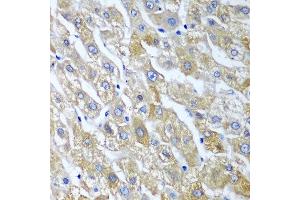 Immunohistochemistry of paraffin-embedded human liver using SGSH antibody at dilution of 1:100 (40x lens). (SGSH Antikörper)