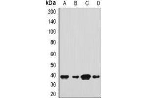 Western blot analysis of SH3GL2 expression in Hela (A), HepG2 (B), mouse brain (C), mouse testis (D) whole cell lysates. (SH3G2 Antikörper)