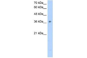 OTC antibody used at 2. (OTC Antikörper  (N-Term))