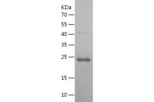 Western Blotting (WB) image for Oncostatin M (OSM) (AA 26-221) protein (His tag) (ABIN7124262)