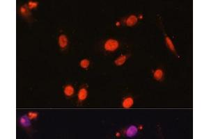 Immunofluorescence analysis of U2OS cells using DDX17 Polyclonal Antibody at dilution of 1:100. (DDX17 Antikörper)