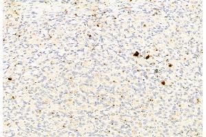 ABIN6264908 and ABIN6277802 at 1/100 staining Rat stomach tissue by IHC-P. (S100A9 Antikörper)