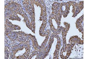 IHC analysis of CD147/Emmprin using anti-CD147/Emmprin antibody (ABIN7599997). (CD147 Antikörper  (AA 138-323))