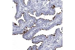 Immunohistochemical staining of human fallopian tube with C1orf114 polyclonal antibody  shows strong membranous positivity in glandular cells. (C1orf114 Antikörper)