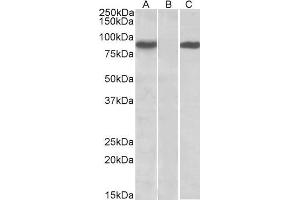 HEK293 lysate (10ug protein in RIPA buffer) overexpressing Human STAT4 (RC206892) with C-terminal MYC tag probed with ABIN571128 (1ug/ml) in Lane A and probed with anti-MYC Tag (1/1000) in lane C. (STAT4 Antikörper  (AA 369-383))