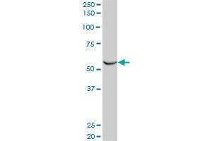 FLI1 monoclonal antibody (M03), clone 2A2. (FLI1 Antikörper  (AA 1-452))