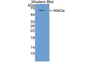 Western blot analysis of the recombinant protein. (BIRC2 Antikörper  (AA 344-593))