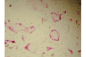 Immunohistochemistry (IHC) image for Osteoclast (Rat) Culture Kit (ABIN956046) (Osteoclast (Ratte) Culture Kit)