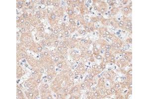 Immunohistochemistry of paraffin-embedded Human liver using GPC3 Polyclonal Antibody at dilution of 1:100 (40x lens). (Glypican 3 Antikörper)