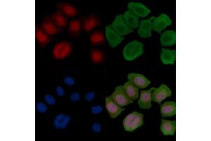 ABIN6255742 and ABIN6266454 staining Hela cells(45 min of heat-shock treatment) by IF/ICC. (Retinoblastoma Protein (Rb) Antikörper  (pThr826))