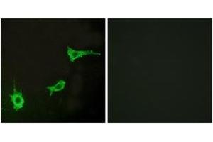 Immunofluorescence analysis of LOVO cells, using EDNRA Antibody. (Endothelin-1 Receptor Antikörper  (AA 378-427))