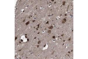 Immunohistochemical staining of human cerebral cortex with PAWR polyclonal antibody  shows strong cytoplasmic and nuclear positivity in neuronal cells and glial cells at 1:50-1:200 dilution. (PAWR Antikörper)