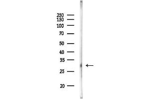 anti-RAB40A, Member RAS Oncogene Family (RAB40A) antibody