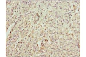 Immunohistochemistry of paraffin-embedded human pancreatic tissue using ABIN7176057 at dilution of 1:100 (ZFYVE1 Antikörper  (AA 1-280))
