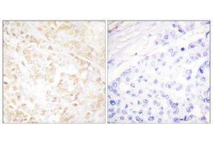Immunohistochemistry (IHC) image for anti-X-Ray Repair Complementing Defective Repair in Chinese Hamster Cells 6 (XRCC6) (C-Term) antibody (ABIN1848905) (XRCC6 Antikörper  (C-Term))