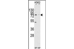 Western blot analysis of anti-JHDM1a/FBXL11 Antibody pre-incubated with(right lane) and without(left lane) blocking peptide in Jurkat cell line lysate. (KDM2A Antikörper  (C-Term))