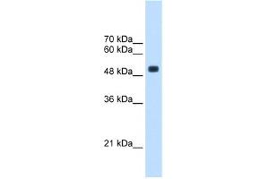 WB Suggested Anti-CXorf34 Antibody Titration:  2. (TRMT2B Antikörper  (Middle Region))