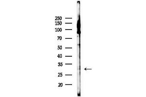 Western blot analysis of lysates from F10-LUC cells(heat-shock,45 min treatment), using Phospho-Bcl-2 (Ser70) Antibody at 1/1000 dilution.