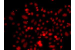 Immunofluorescence analysis of A549 cell using RRAGC antibody. (GTR2 Antikörper)
