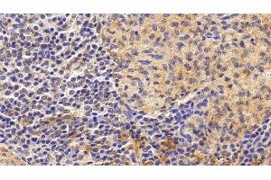 Detection of IL6 in Human Spleen Tissue using Monoclonal Antibody to Interleukin 6 (IL6) (IL-6 Antikörper  (AA 29-212))