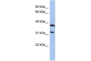 WB Suggested Anti-ASPA Antibody Titration: 0. (ASPA Antikörper  (Middle Region))