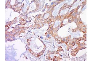Immunohistochemistry (Paraffin-embedded Sections) (IHC (p)) image for anti-BCL2-Antagonist/killer 1 (BAK1) (AA 21-120) antibody (ABIN674409)