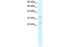 ZNF385 antibody used at 0.