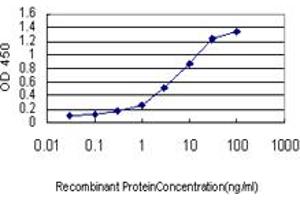 Detection limit for recombinant GST tagged IRAK3 is approximately 0. (IRAK3 Antikörper  (AA 497-596))
