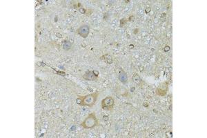 Immunohistochemistry (Paraffin-embedded Sections) (IHC (p)) image for anti-Crystallin, mu (CRYM) (AA 1-314) antibody (ABIN1679371)
