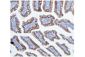 IHC analysis of Hexokinase 1/HK1 using anti-Hexokinase 1/HK1 antibody (ABIN7600259). (Hexokinase 1 Antikörper  (AA 17-323))
