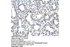 Rabbit Anti-PRMT5 Antibody  Paraffin Embedded Tissue: Human Lung Cellular Data: Alveolar cells Antibody Concentration: 4.