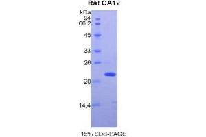 SDS-PAGE (SDS) image for Carbonic Anhydrase 12 (CA12) (AA 154-307) protein (His tag) (ABIN1877870)