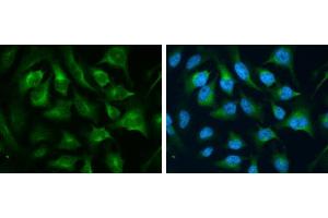 ICC/IF Image CD71 antibody [N2C1], Internal detects CD71 protein at cytoplasm by immunofluorescent analysis. (Transferrin Receptor Antikörper)