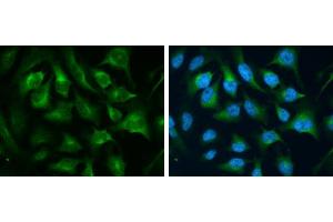 ICC/IF Image CD71 antibody [N2C1], Internal detects CD71 protein at cytoplasm by immunofluorescent analysis. (Transferrin Receptor Antikörper)