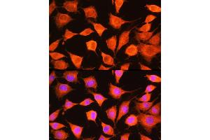 Immunofluorescence (IF) image for anti-phosphorylase Kinase, gamma 2 (Testis) (PHKG2) (AA 237-406) antibody (ABIN6145563)