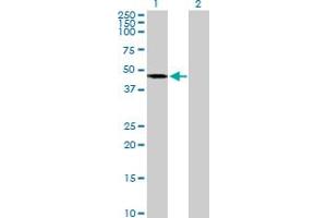 Western Blot analysis of AGK expression in transfected 293T cell line by AGK MaxPab polyclonal antibody. (Acylglycerol Kinase Antikörper  (AA 1-422))
