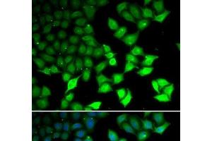 Immunofluorescence analysis of U2OS cells using KDM4B Polyclonal Antibody (KDM4B Antikörper)
