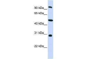 WB Suggested Anti-EML1 Antibody Titration: 0. (EML1 Antikörper  (C-Term))