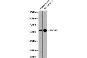 Western blot analysis of extracts of various cell lines, using PRDM11 antibody (ABIN6128494, ABIN6146129, ABIN6146131 and ABIN6224586) at 1:1000 dilution. (PRDM11 Antikörper  (AA 228-477))
