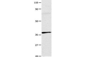 Gel: 10 % SDS-PAGE Lysates (from left to right): Mouse testis tissue Amount of lysate: 20 μg per lane Primary antibody: 1/100 dilution Secondary antibody dilution: 1/8000 Exposure time: 1 minute (Adenosine A3 Receptor Antikörper  (Internal Region))