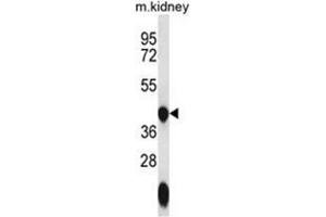 Western blot analysis of GTPBP10 Antibody (C-term) in mouse kidney tissue lysates (35ug/lane). (GTPBP10 Antikörper  (C-Term))