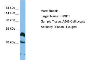 Western Blotting (WB) image for anti-Thrombospondin, Type I, Domain Containing 1 (THSD1) (Middle Region) antibody (ABIN2783714)