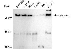 Western blotting analysis using Versican antibody (ABIN7800829). (Rekombinanter Versican Antikörper)