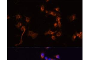 Immunofluorescence analysis of A431 cells using ABL1 Polyclonal Antibody at dilution of 1:100 (40x lens). (ABL1 Antikörper)
