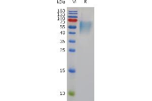 SDS-PAGE (SDS) image for Interleukin 17 Receptor A (IL17RA) (AA 32-322) protein (His tag) (ABIN7491057)