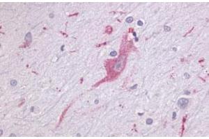 Immunohistochemical (Formalin/PFA-fixed paraffin-embedded sections) staining in human brain, neurons and glia with LPHN1 polyclonal antibody . (Latrophilin 1 Antikörper  (Extracellular Domain))