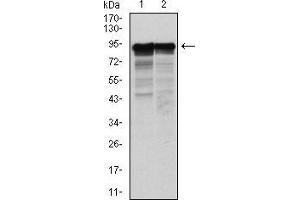 Western blot analysis using NEFL mouse mAb against Hela (1) and Jurkat (2) cell lysate. (NEFL Antikörper)