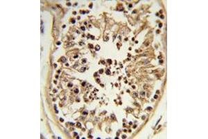 Immunohistochemistry analysis of human testis tissue (formalin-fixed, paraffin-embedded) using Chondroitin sulfate synthase 2  Antibody , which was peroxidase-conjugated to the secondary antibody, followed by DAB staining. (CHPF Antikörper  (Middle Region))