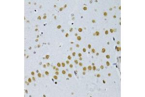 Immunohistochemistry of paraffin-embedded mouse brain using SNRNP70 antibody. (SNRNP70 Antikörper  (AA 150-250))