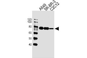 Lane 1: A549 Cell lysates, Lane 2: SK-BR-3 Cell lysates, Lane 3: C2C12 Cell lysates, probed with CAPN2 (1381CT669.